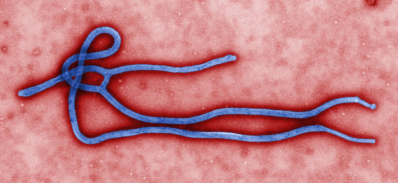 WHO Declares Unprecedented Ebola Emergency Without Committee Backing